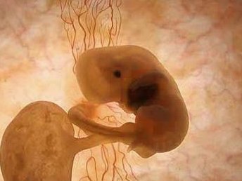 巴彦淖尔市生孩子做染色体检查有必要吗，筛查一次大概需要多少钱？